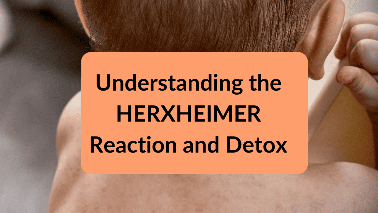 HERXHEIMER Reaction Detox | How to Minimize Effects